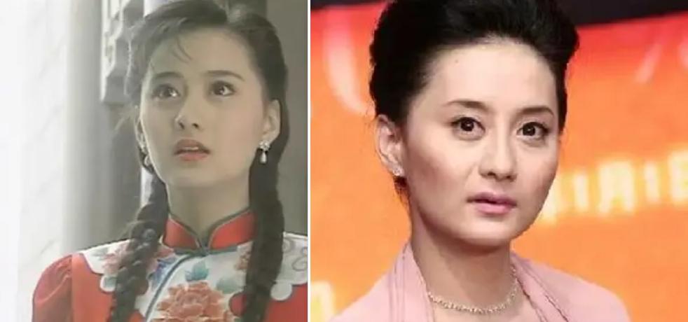 方脸和高颧骨怎么抗老,高颧骨好看还是低颧骨抗老