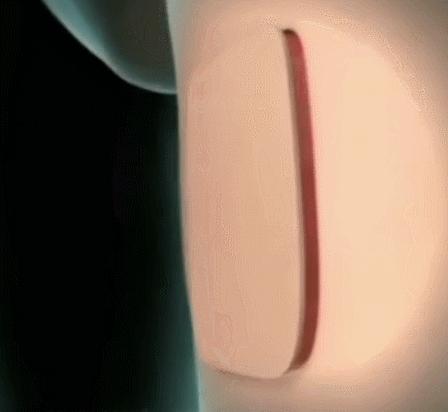 再生医学日本,日本再生医学治疗肾最新进展