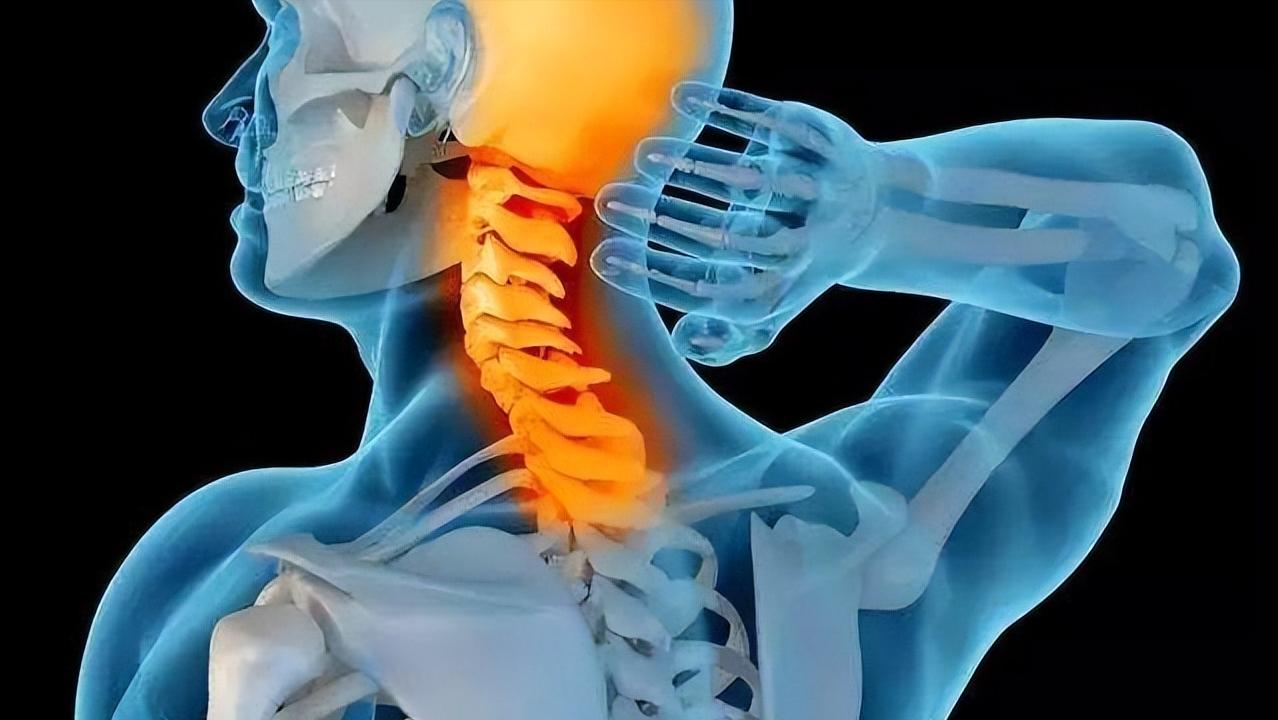 这是一封医生写给颈椎病患者的长信！如果您深受其扰，请看此文