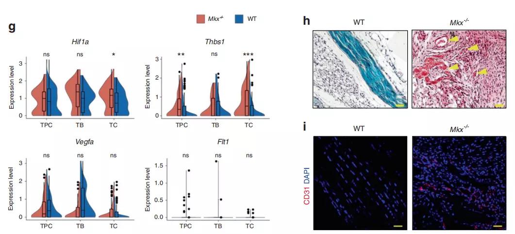 异位骨化的研究进展,肌萎缩侧索硬化症新药研究进展