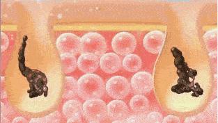 科颜氏白泥面膜清洁去黑头125ml,科颜氏白泥面膜真的能去黑头吗