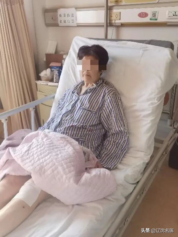 人工髋关节翻修3d打印,大连医院骨科3d打印