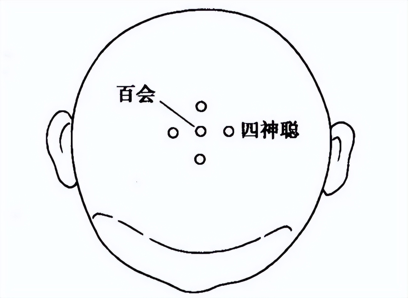 广州治失眠名中医排名榜,治疗失眠最好的中医专家