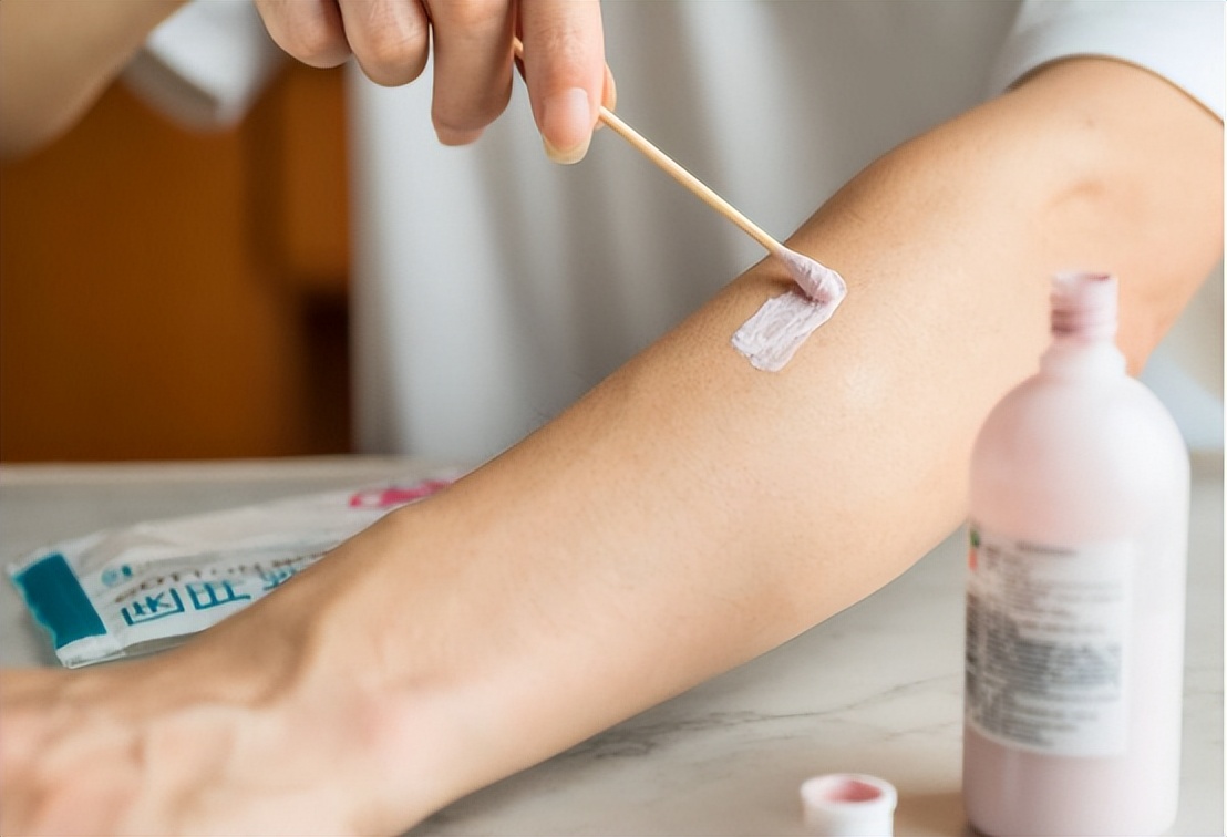 医生：2块钱一支的红霉素软膏不是万能药，别乱用