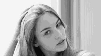 头皮屑太多了怎么处理我教你一招,头皮痒头皮屑多有救了