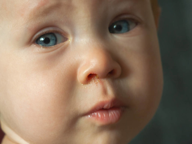 孩子有内热怎么清内热,内热的症状与副作用