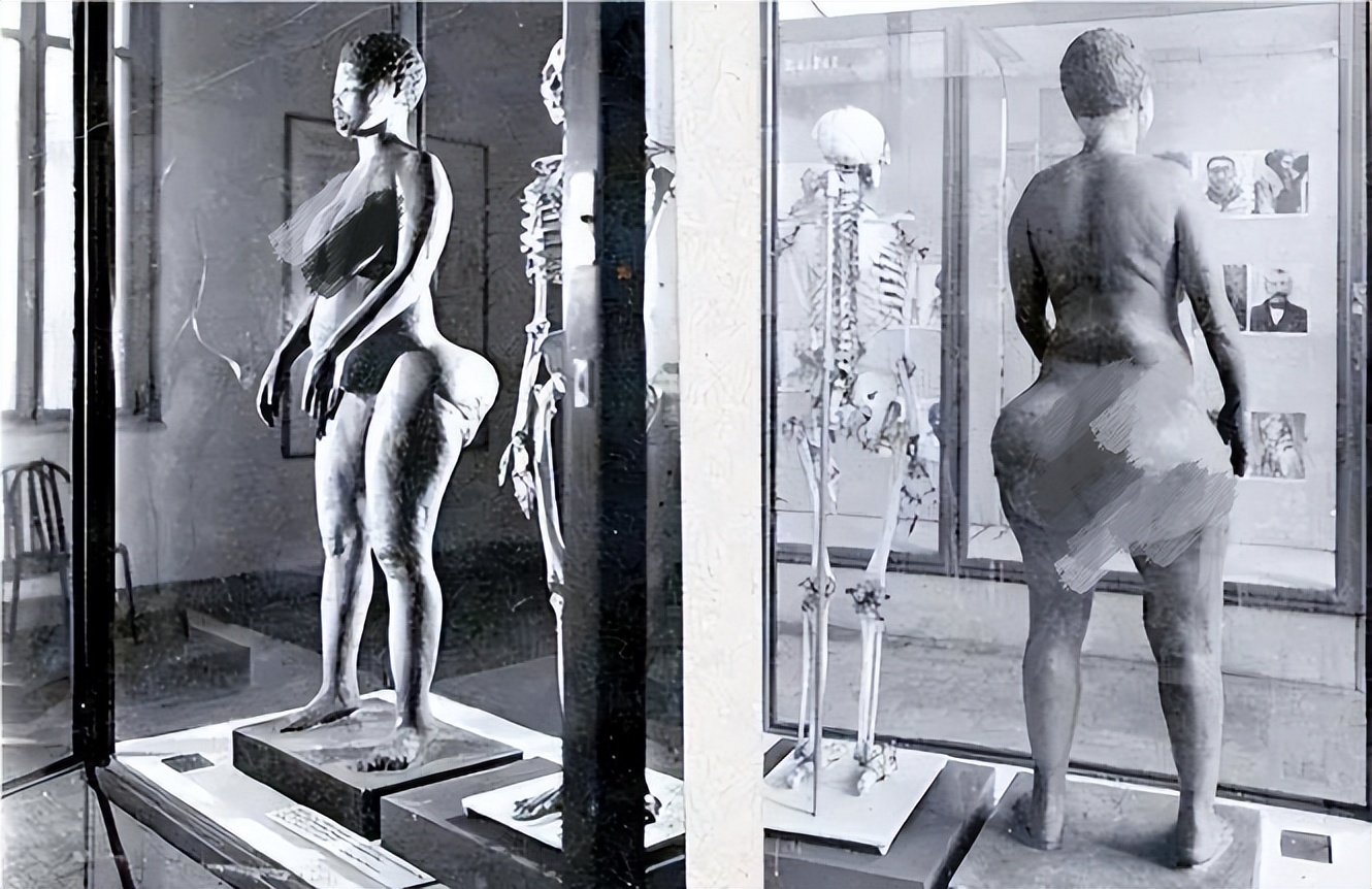 非洲女孩巴特曼因有巨臀,一生被赤身裸体展览,死后还被做成标本