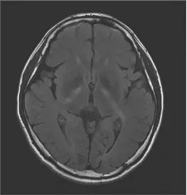 男子脚上有一个大包,小伙脚上长了个大脓包