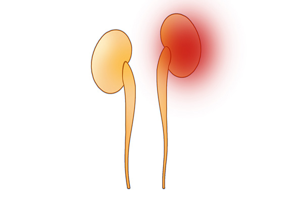 “我还年轻，血压高一点没事”错，若不及时降压，警惕3大并发症