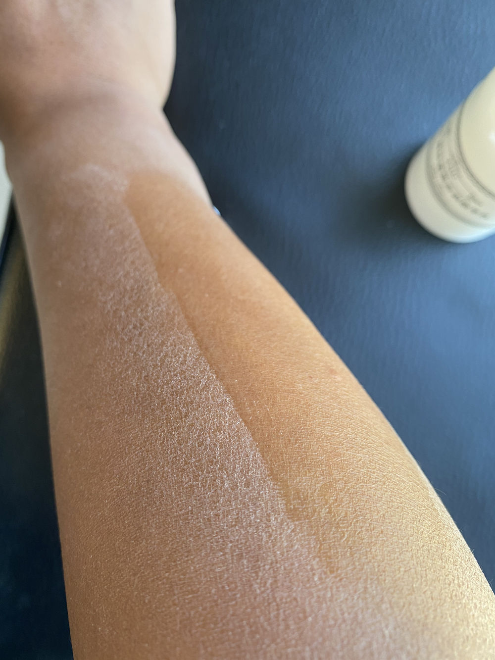 皮肤洗不干净老是脱皮,不洗澡身上晒得脱皮了怎么办