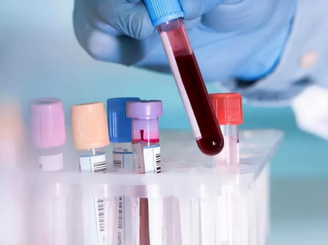 a型b型o型ab型血哪个比较健康,a型b型ab型o型哪种血容易生病