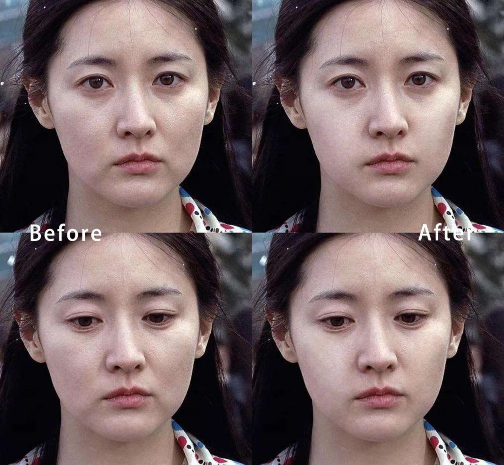 面部平整度是什么意思,怎样提高面部平整度