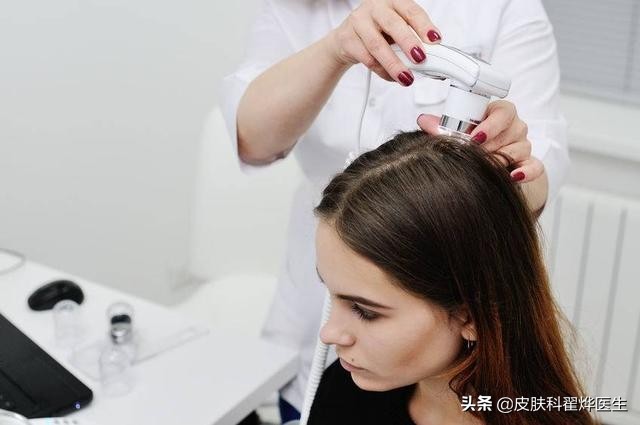 脱发头发出油原因有三种,头皮干了会脱发还是油了会脱发