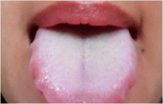 过敏性鼻炎中医上讲是怎么引起的,鼻炎的常见种类及六个小妙招