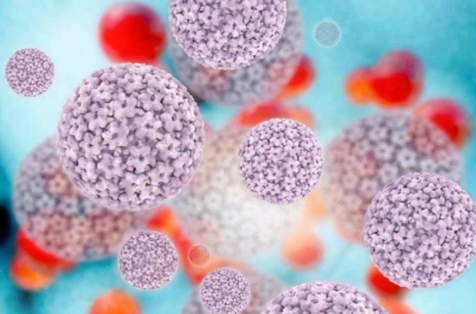 不论男女，身上长出这5种“瘊子”，或已感染HPV病毒！千万别轻视