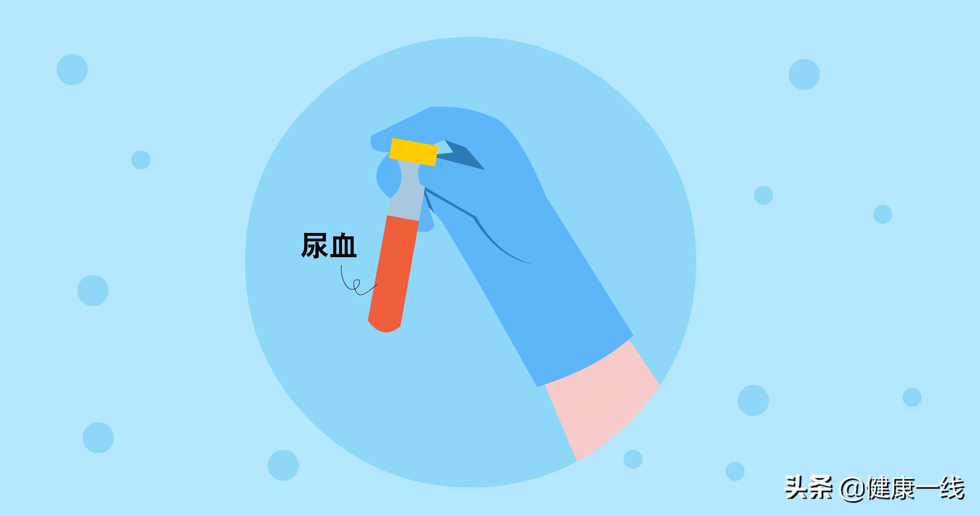 尿痛而且流脓,尿痛出血是什么原因