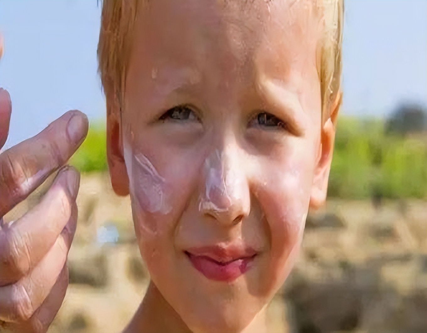 炉甘石洗剂搭配什么祛痘,炉甘石洗剂能用在哪些皮肤病