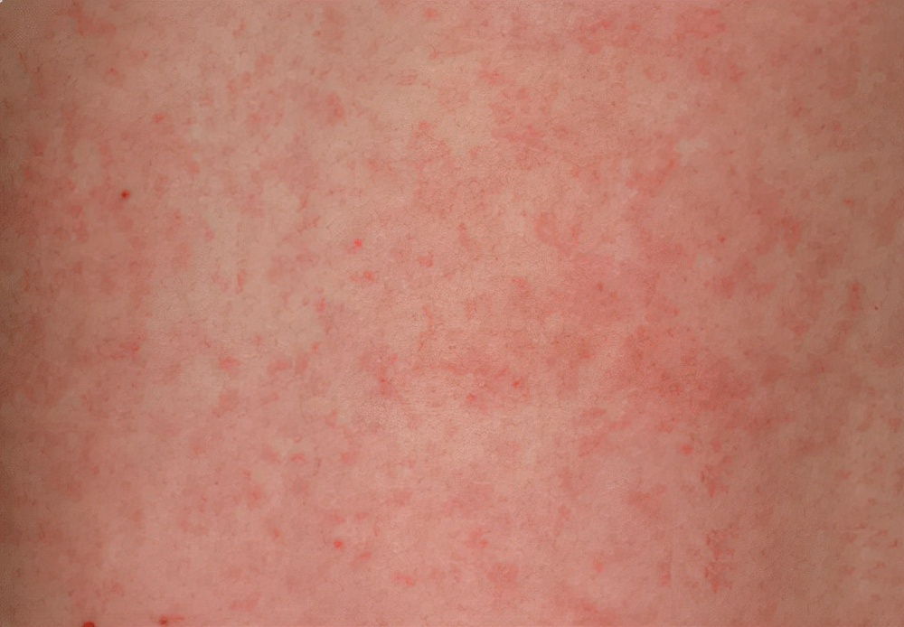 感冒、发烧总是治不好？可能得了这种病......