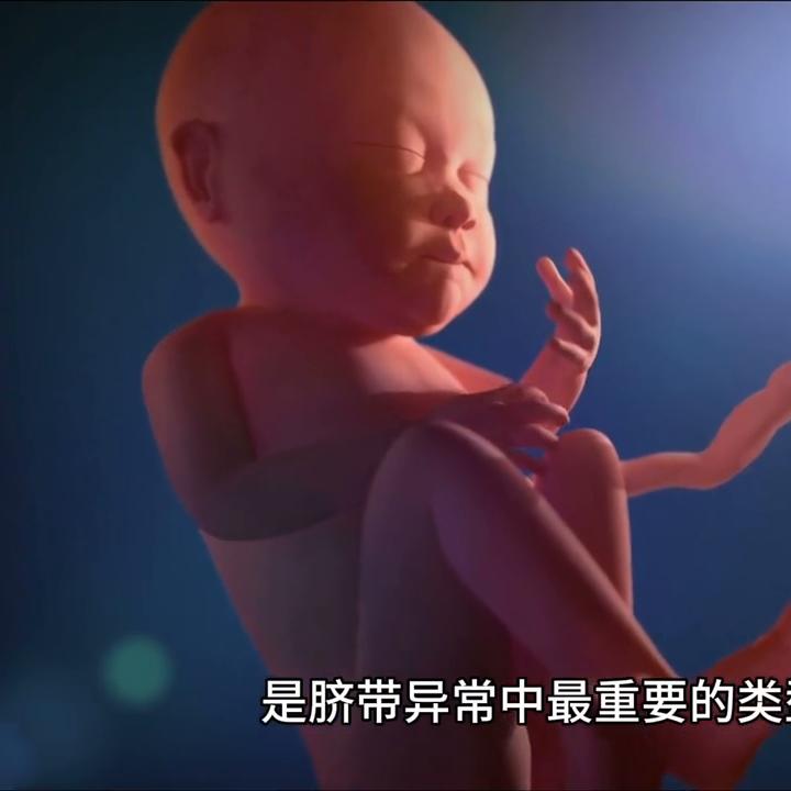 脐带打结跟脐带缠绕有什么区别,脐带绕颈一周有什么办法绕出来