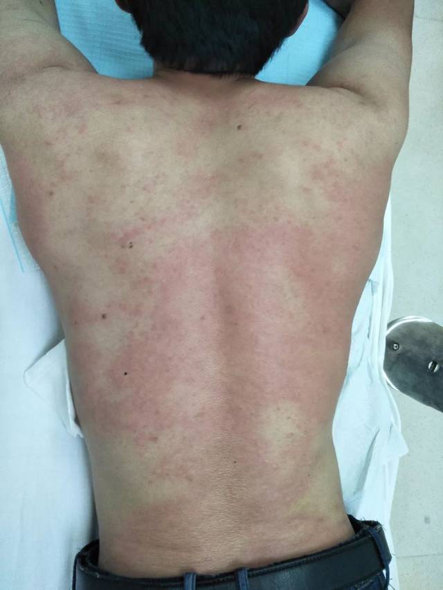 上海交大博士白血病放弃治疗,上海交大29岁硕士白血病复发