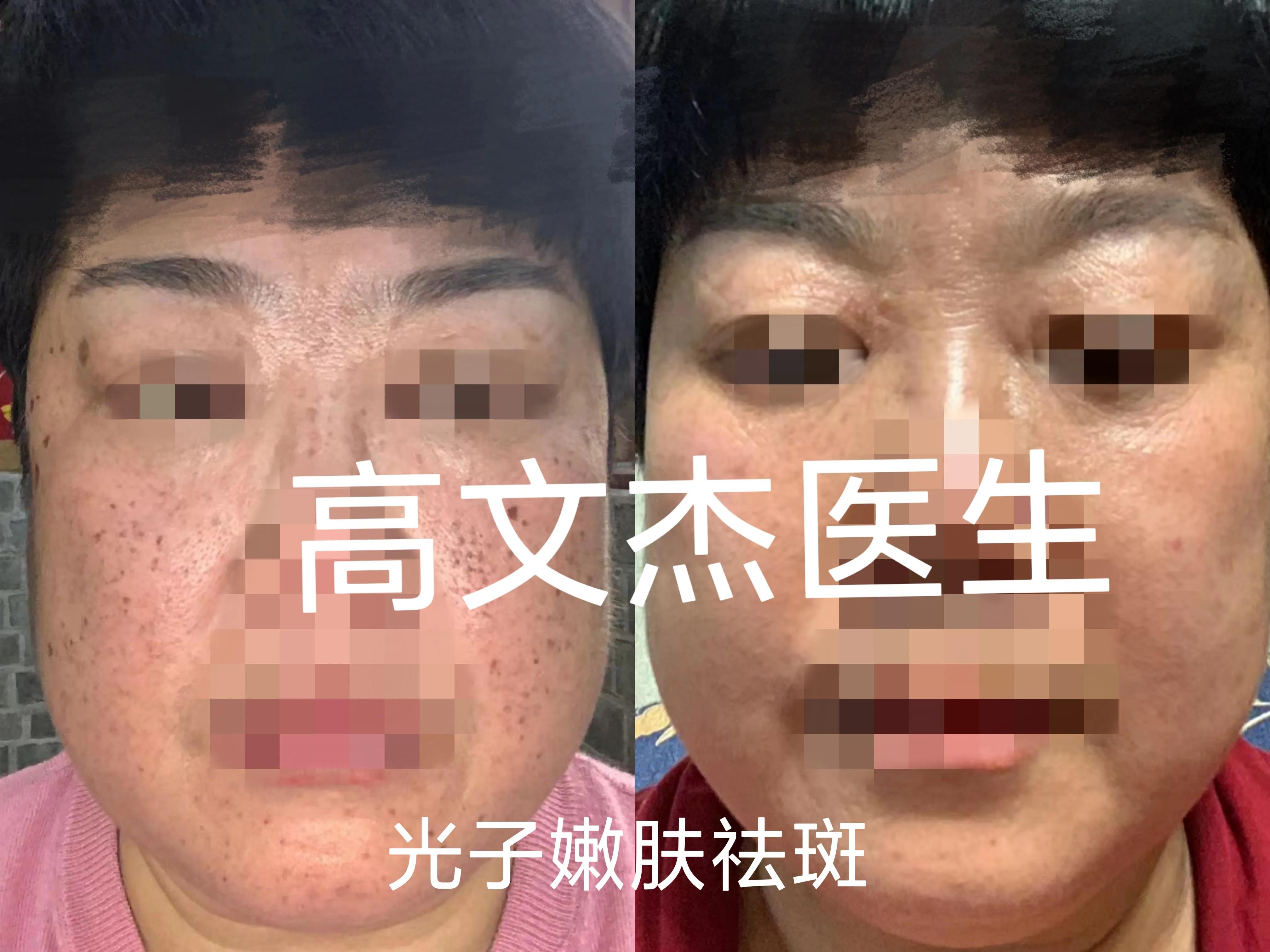 一句话帮你总结哪些医美项目,减龄的医美项目有哪些