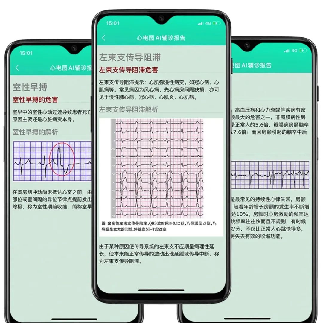 哪款智能手表睡眠监测最精准,血氧心率监测准确的智能手表推荐