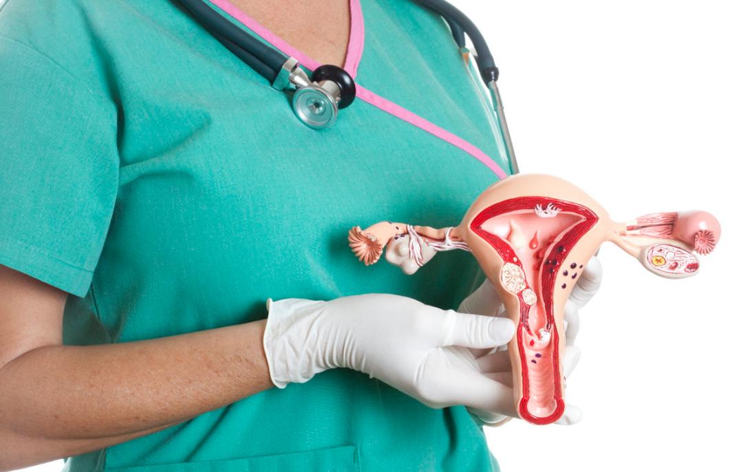 45岁女子确诊宫颈癌,子宫全切,提醒:月经若有这种感觉,别大意