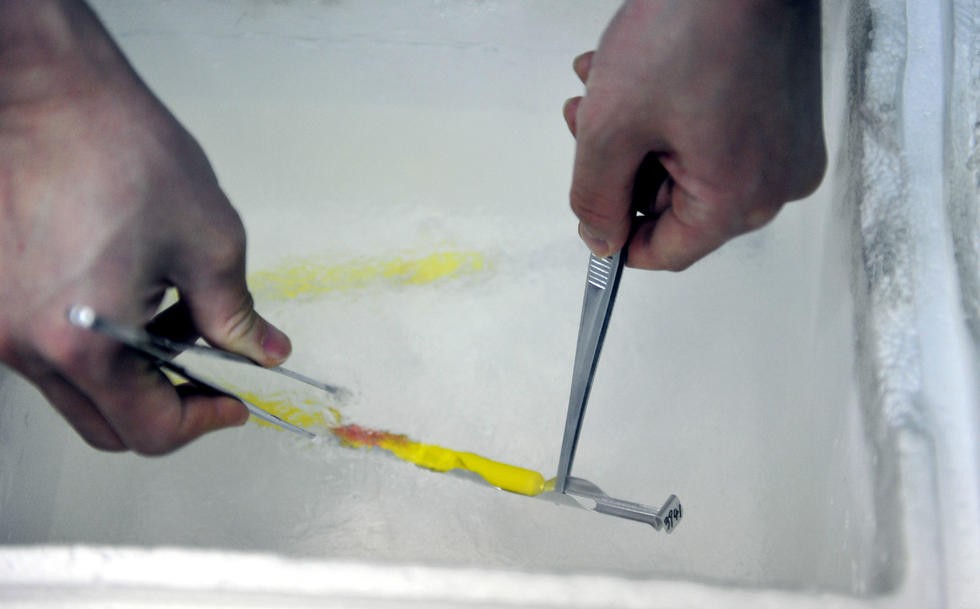 没有阴道的女人，和正常女性有何差异?“石女”到底是怎么回事?