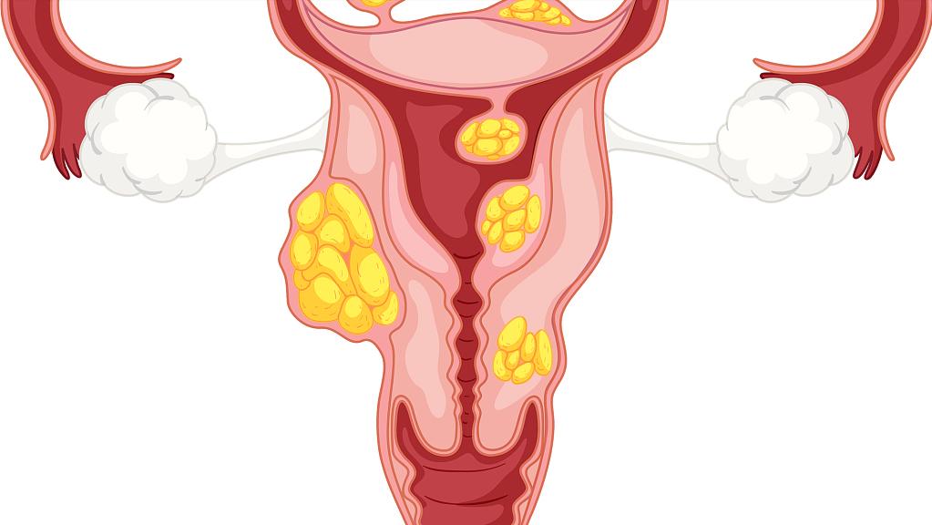 30多岁没有子宫有什么影响,没有子宫的女人可以试管吗