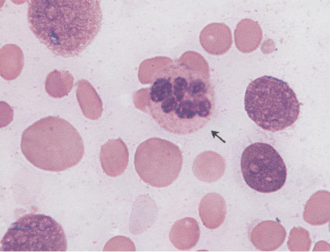 甲钴胺就是B12吗,甲钴胺就是营养神经的吗