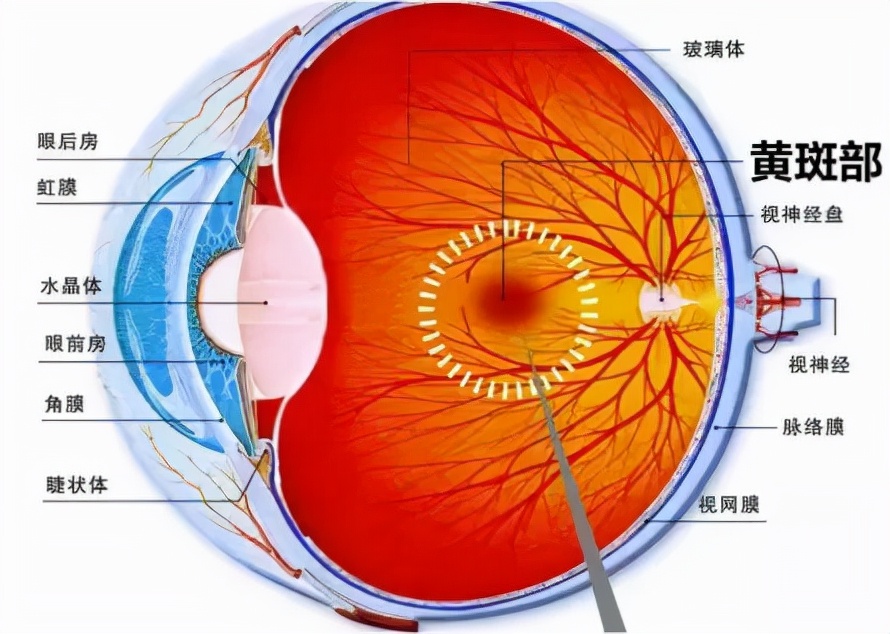 黄斑变性疾病科普知识,黄斑变性一定失明吗