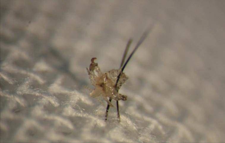 孩子眼睛长阴虱怎么处理,阴虱长在小孩眼睫毛上