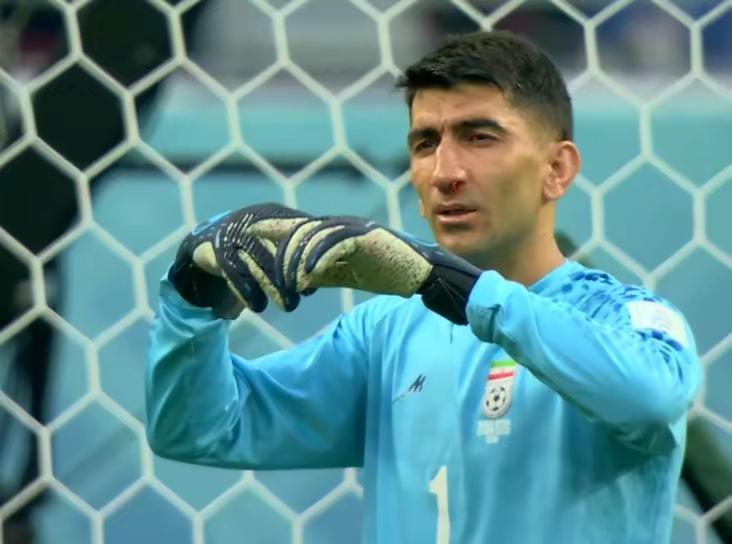 世界杯英格兰vs伊朗萨卡,伊朗世界杯战绩