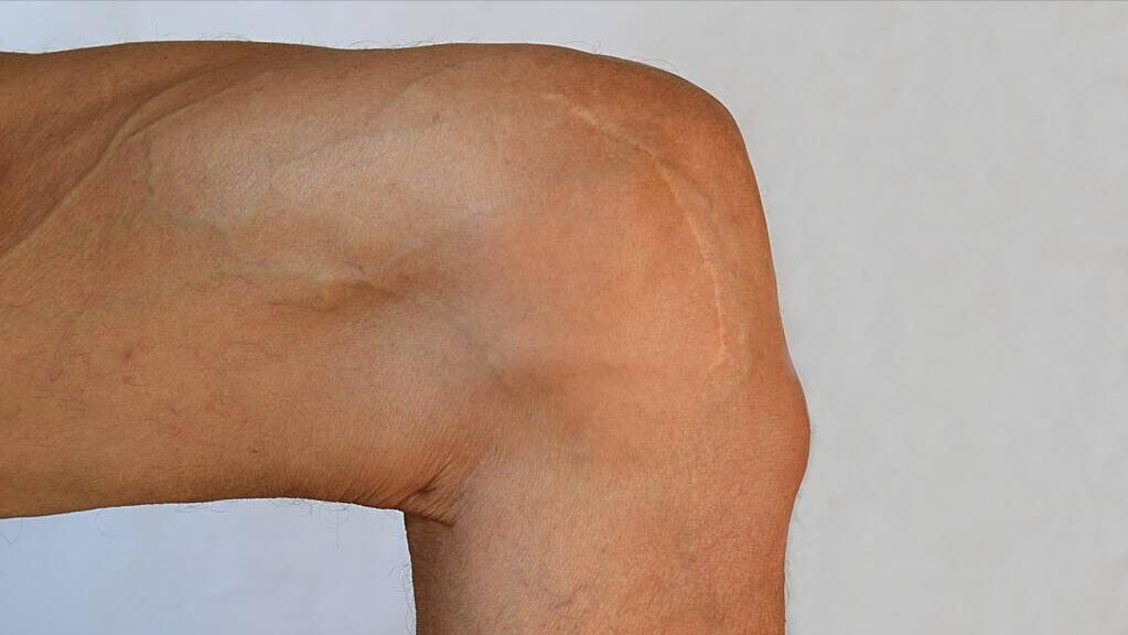 北京医院刁永鹏医师,北京医院血管外科刁永鹏