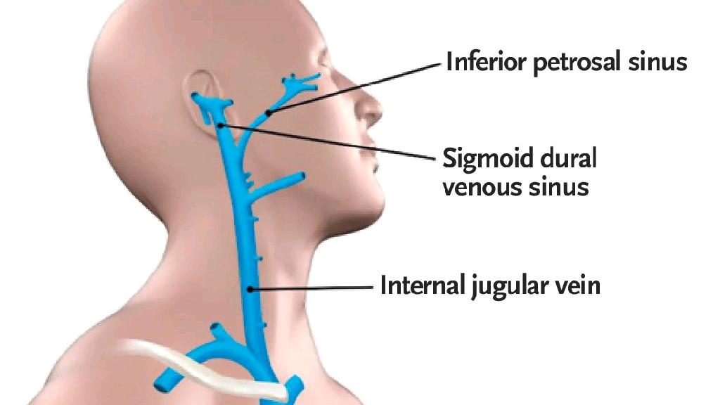 男女之间亲吻有什么害处,男女之间亲吻的禁忌