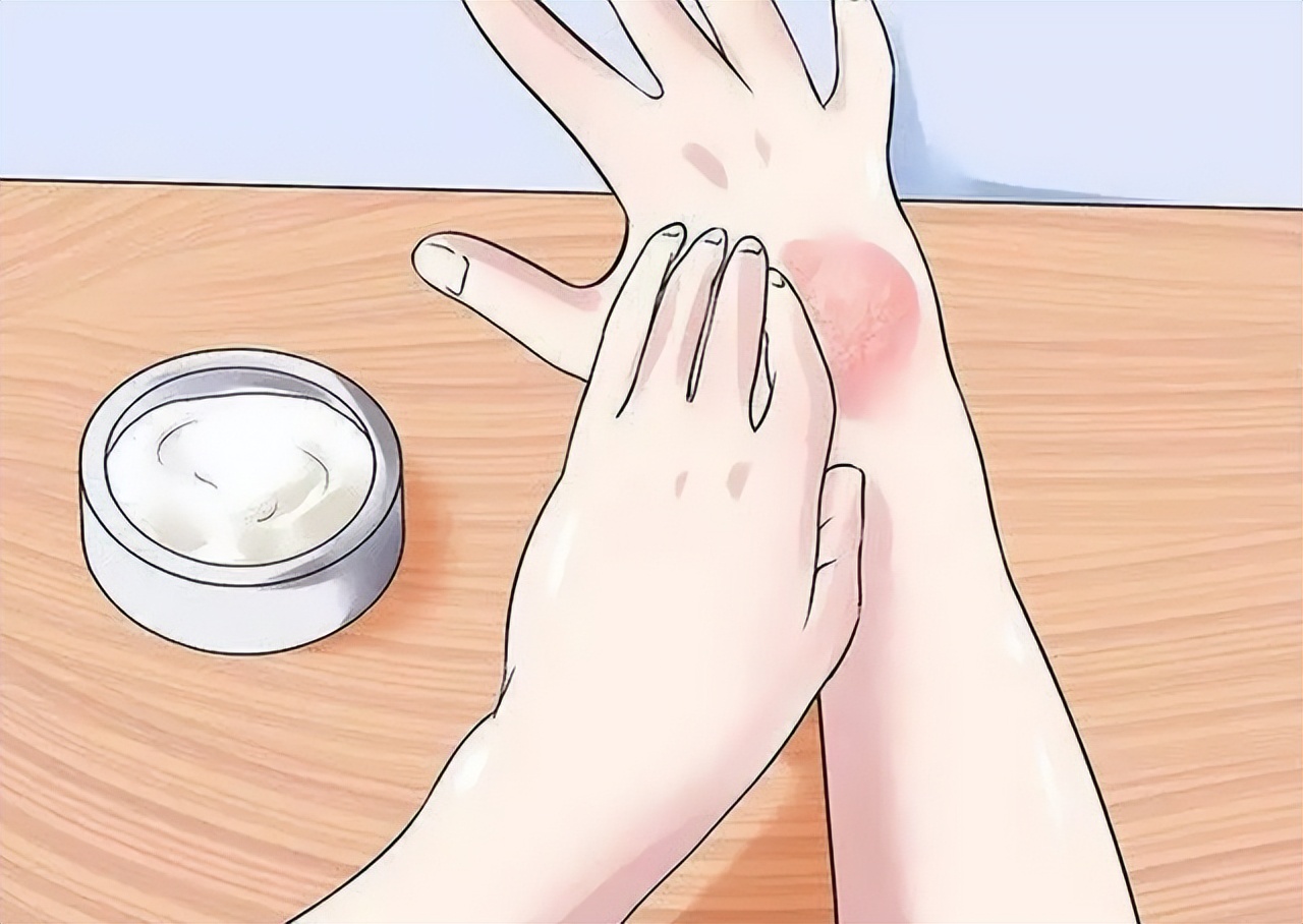 头皮上经常长脓包和疙瘩,是怎么回事?医生:或和这3种问题有关