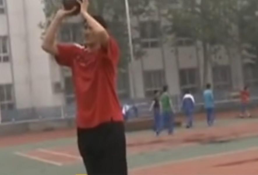 男子身患巨人症身高竟有两米四二,外国夫妇生了巨人症的孩子