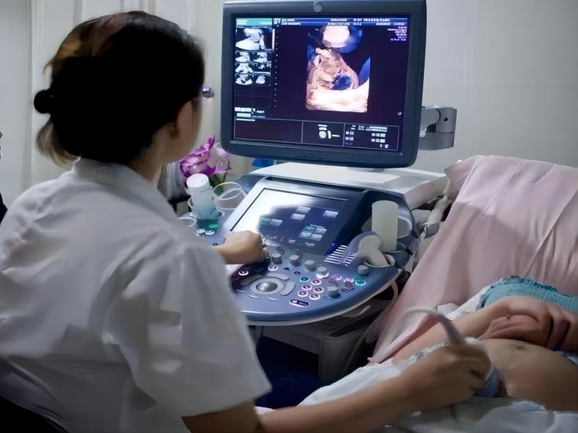 女子生下连体双胞胎后续,女子产下同母异父双胞胎完整版