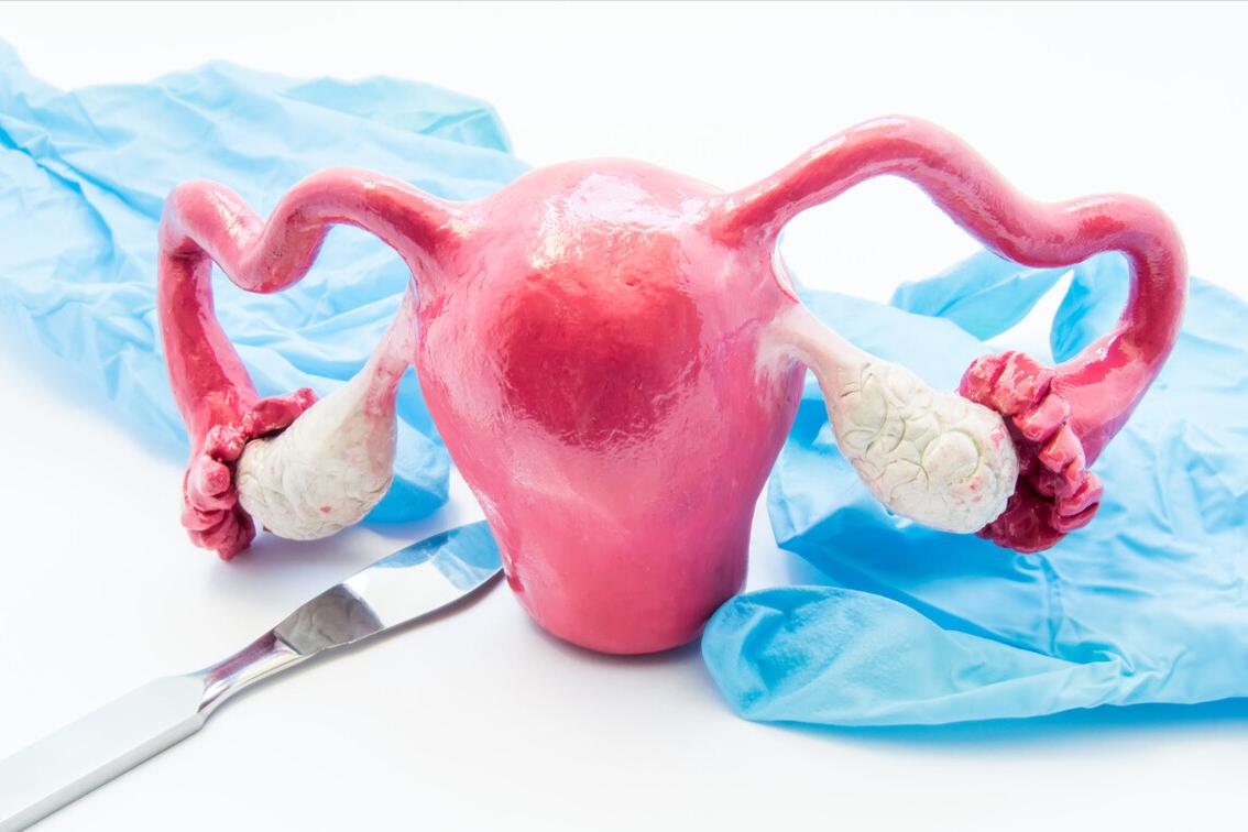 派特灵派特生物科普｜HSIL全子宫切除术治疗的最新中国专家共识