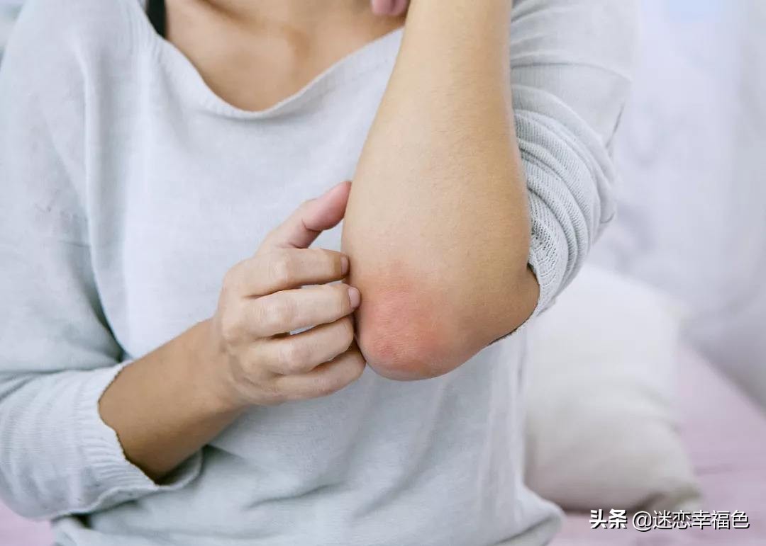 一到冬天就全身瘙痒,一到冬天全身皮肤瘙痒是什么原因