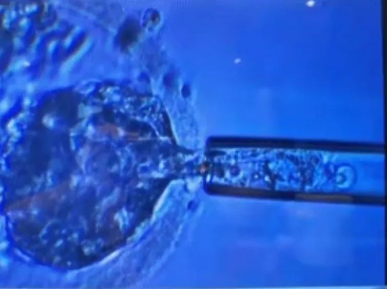 好多高龄孕妇都会流产一次,高龄孕妇容易流产的原因