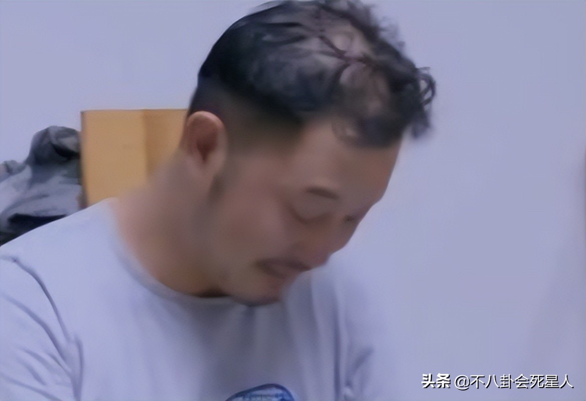 脸部垮掉的男人,脸部塌陷的男生