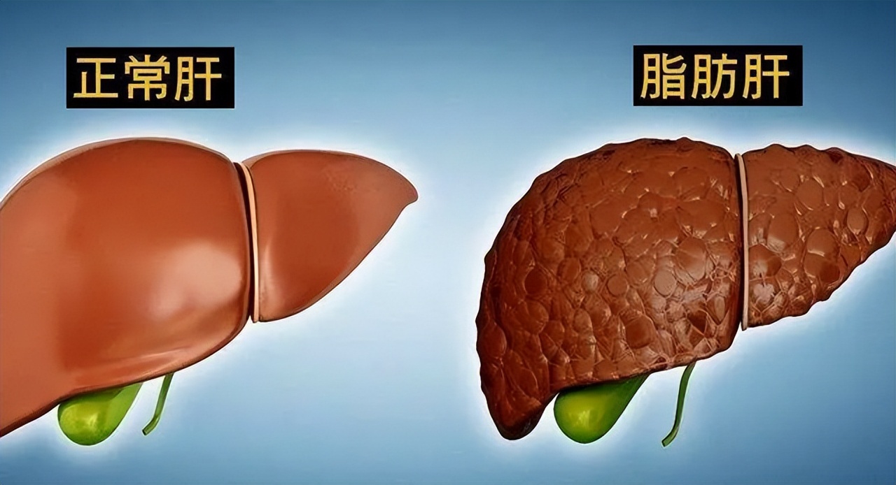 成年男性体重身高标准对照表,男性年龄身高体重对照表2021年