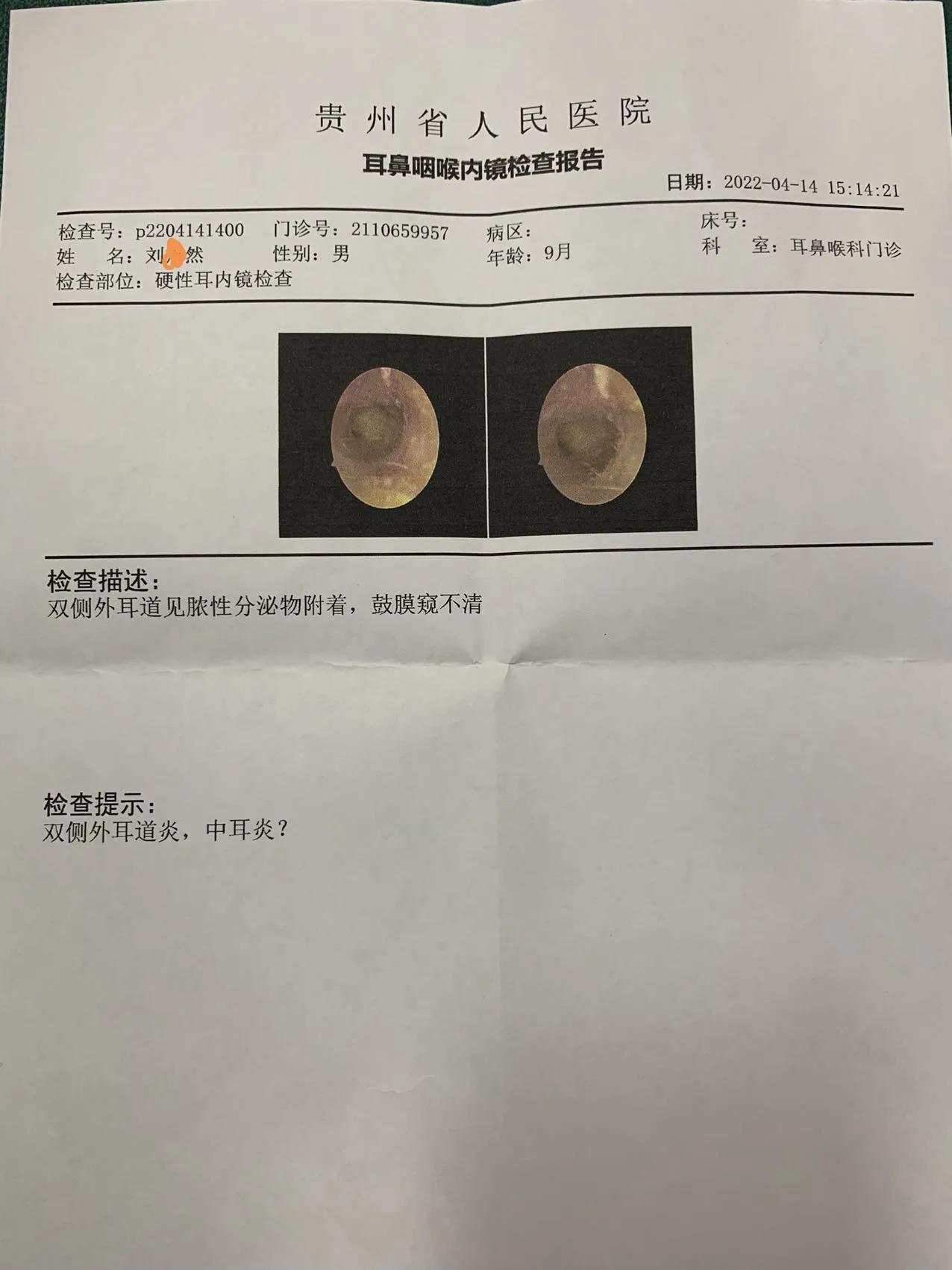 反复化脓中耳炎怎么治疗,急性中耳炎耳朵流脓怎么暂时解决