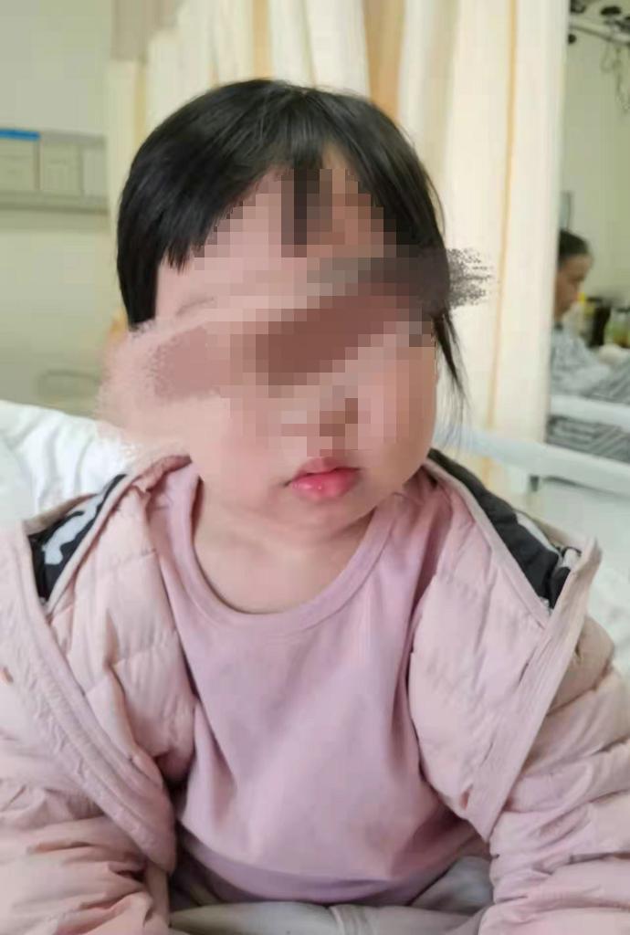 儿童落枕最快恢复办法,落枕了30秒自愈方法儿童