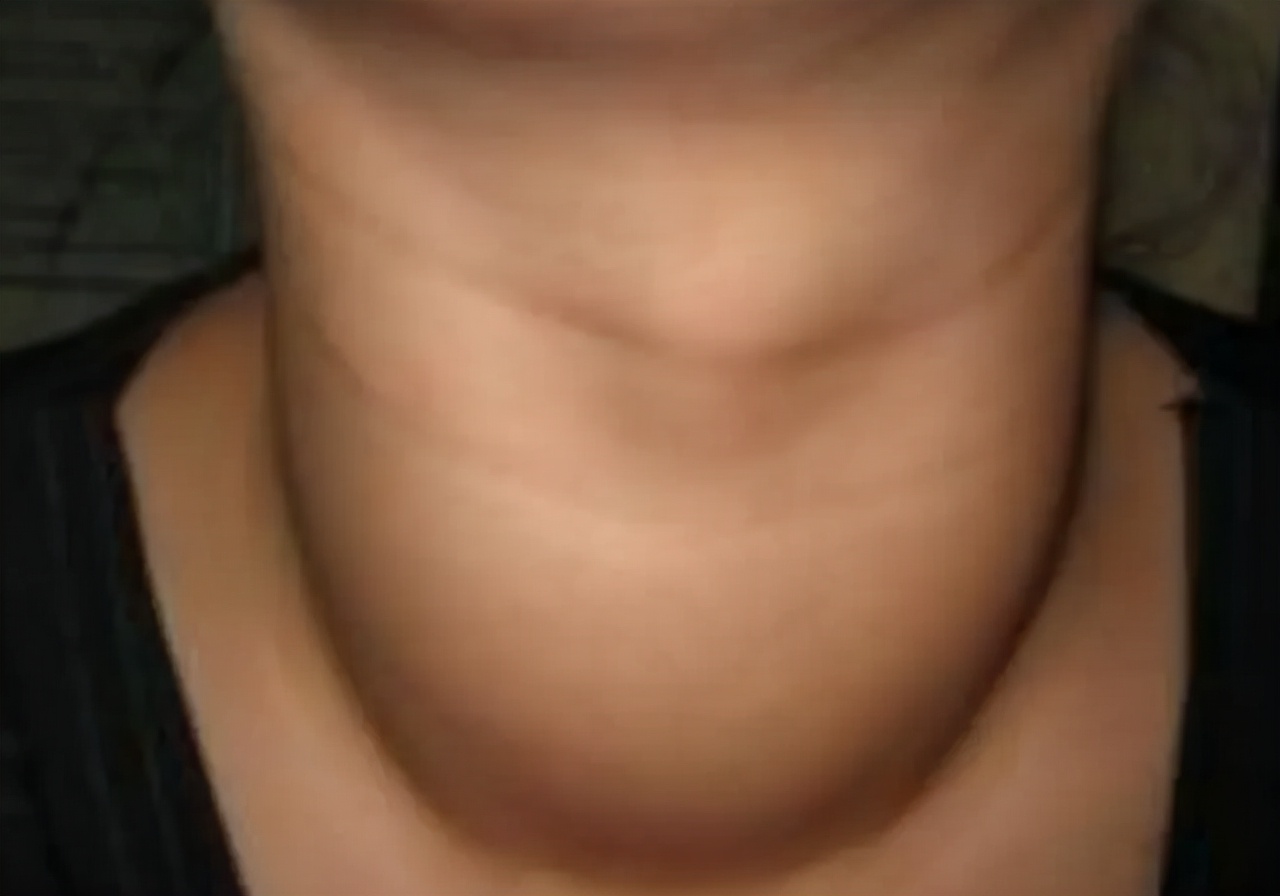 晚上睡觉嘴和嗓子发干是什么原因,晚上睡觉总是感觉嘴干怎么回事