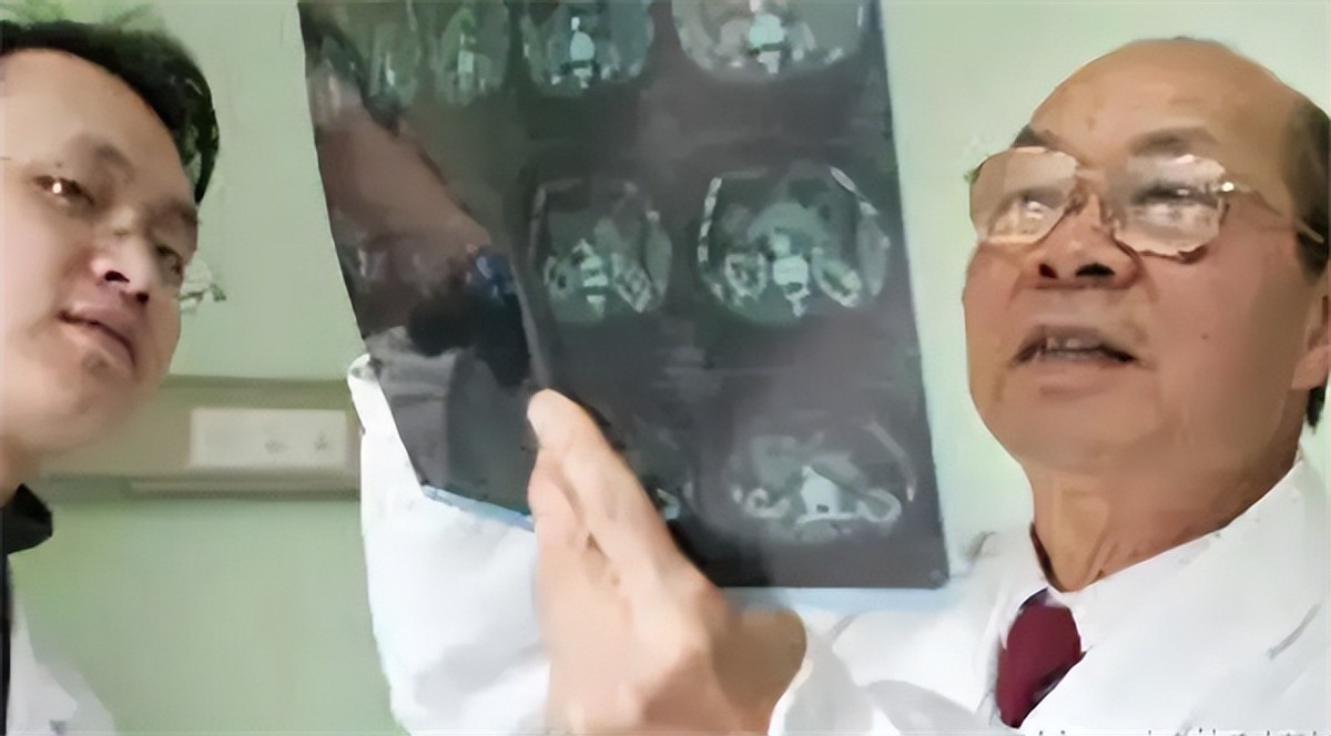 汤钊猷抗癌处方,汤钊猷癌症不能盲目手术