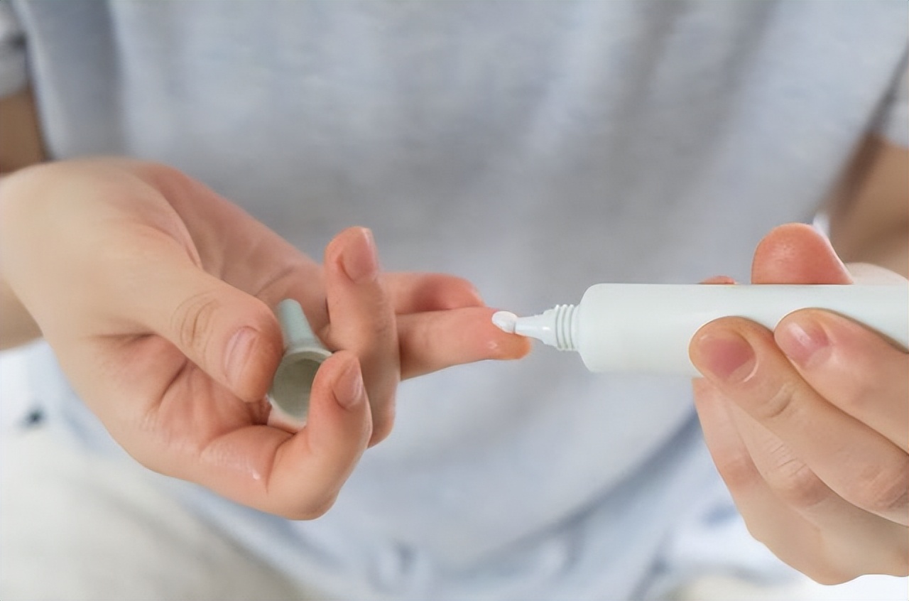 人长老年斑是什么原因,快速消除老年斑的小妙招红霉素