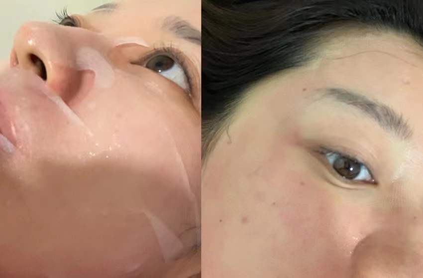 缩小毛孔做水光还是点阵,小姐姐直播说收缩毛孔