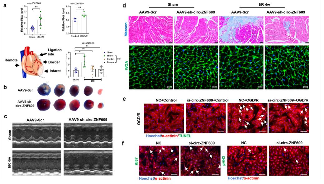 缺血性心脏病能治好么,心肌缺血再灌注诊断和治疗指南